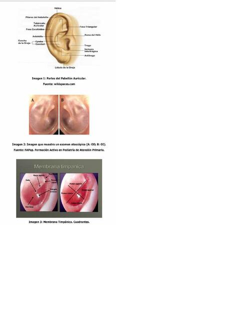 moldes y impresion