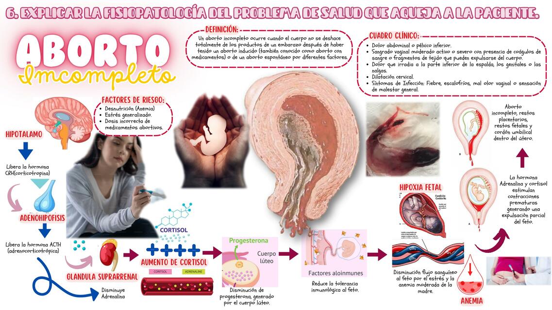 FISIOPATOLOGÌA DEL ABORTO INCOMPLETO, POR ESTRES