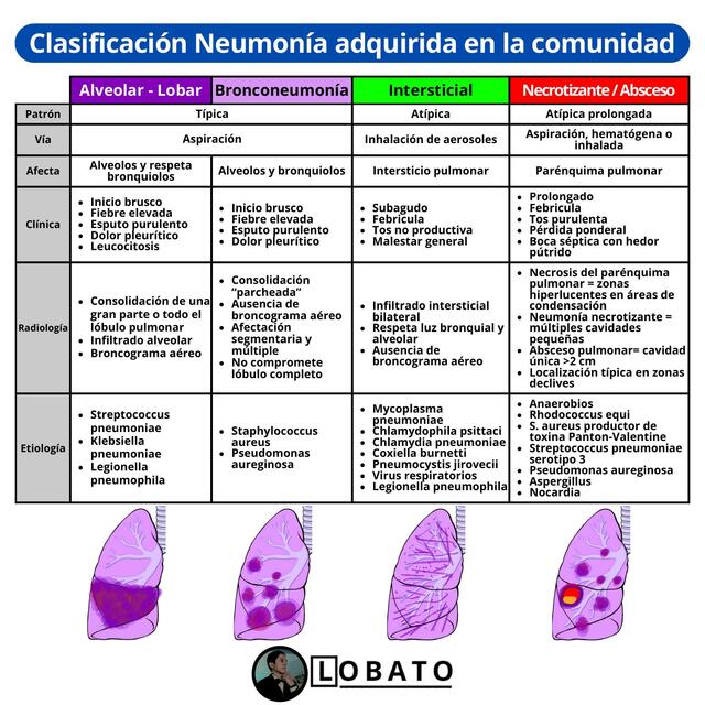 Clasificación de Neumonía 🩺| lobar, bronconeumonía, intersticial