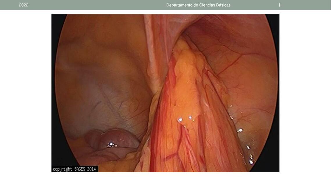 18 REGION INGUINAL