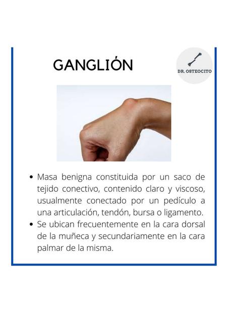 Ganglión