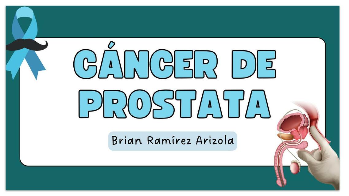 CANCER DE PROSTATA