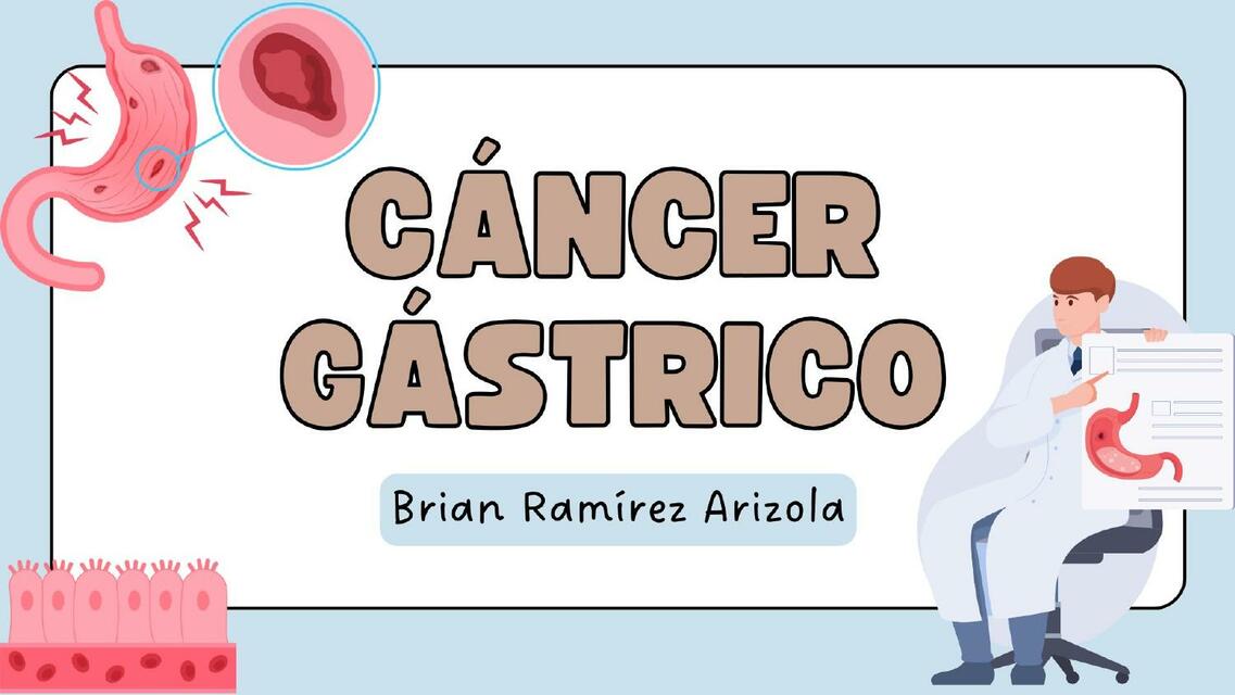 CANCER GASTRICO