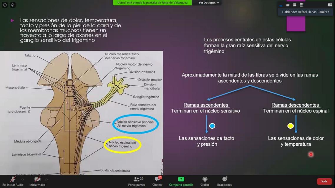 trigemino