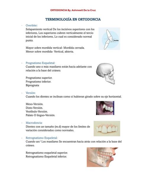 TERMINOLOGÍA EN ORTODONCIA