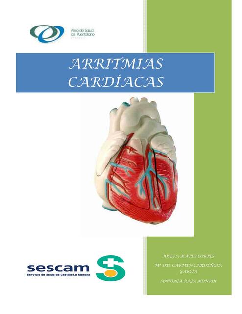 ARRITMIAS CARDIACAS