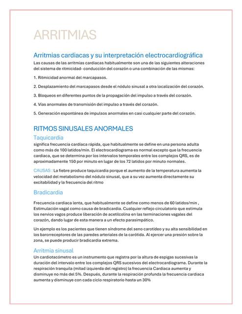 ARRITMIAS ECG