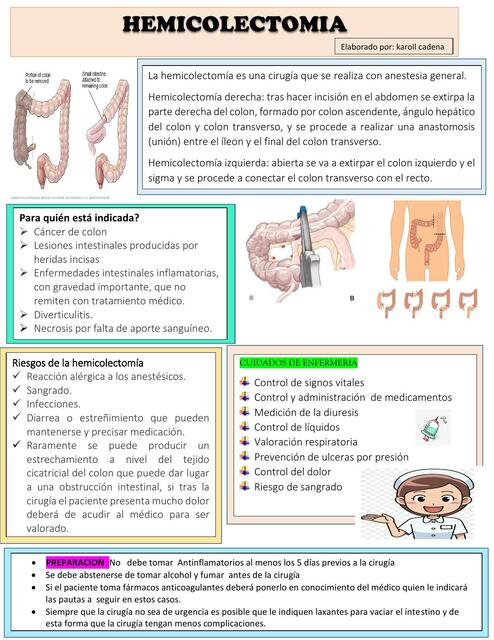 INFOGRAFIA HEMICOLECTOMIA | karol cadena | uDocz