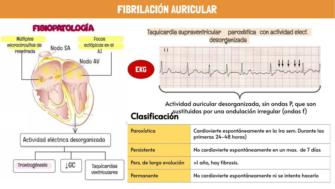 Fibrilación auricular diapositivas