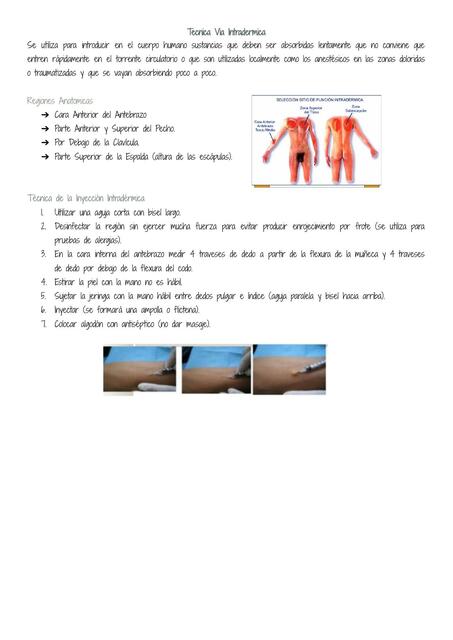 Técnica Vía: Intradérmica