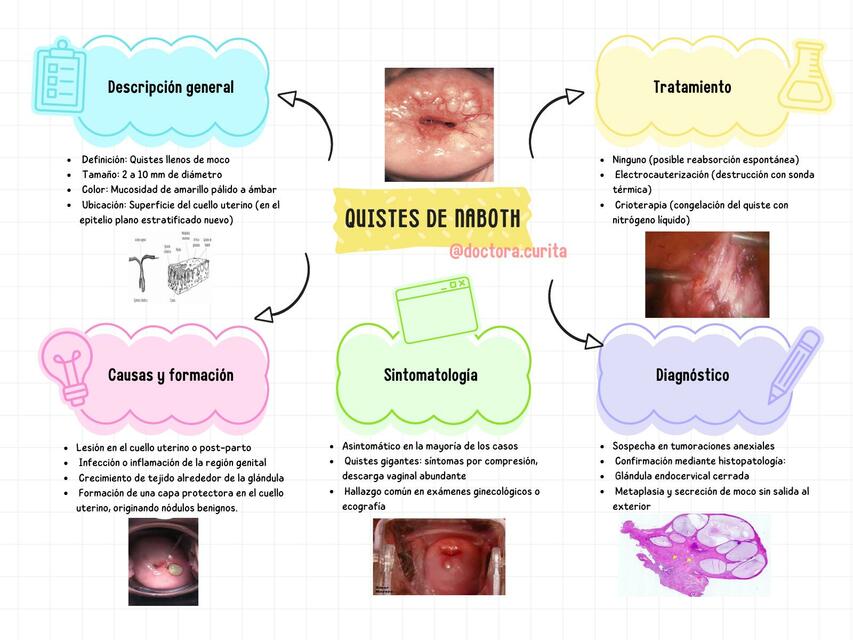 Quistes de Naboth