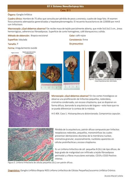 Casos UT8 Sistema hemolinfopoyetico | Julieta | uDocz