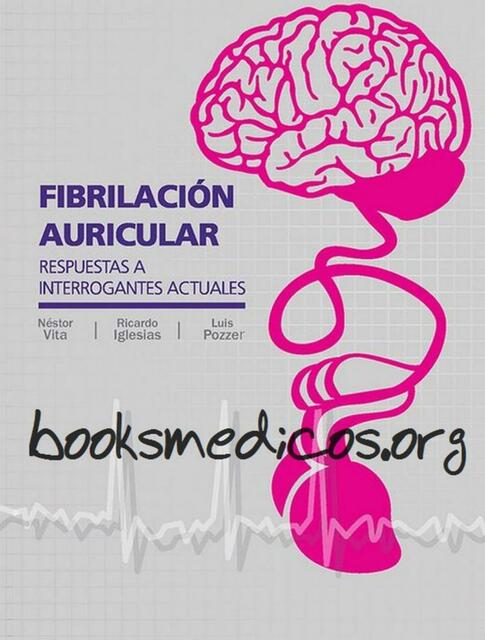 Fibrilacion Auricular Respuestas a Interrogantes Actuales VITA