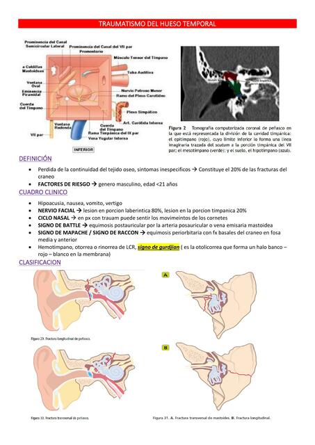 TEMA 3 TRAUMATISMO DEL HUESO TEMPORAL