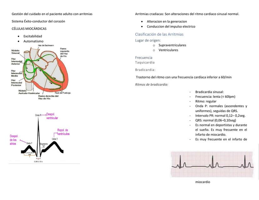 Arritmias