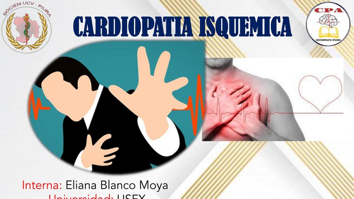 Cardiopatía Isquémica 