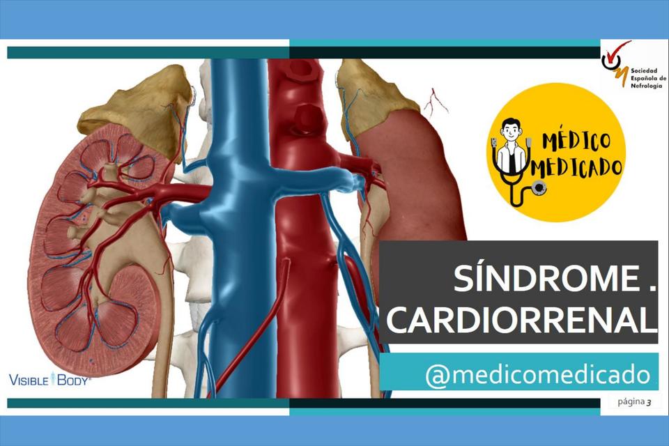 Síndrome cardiorrenal