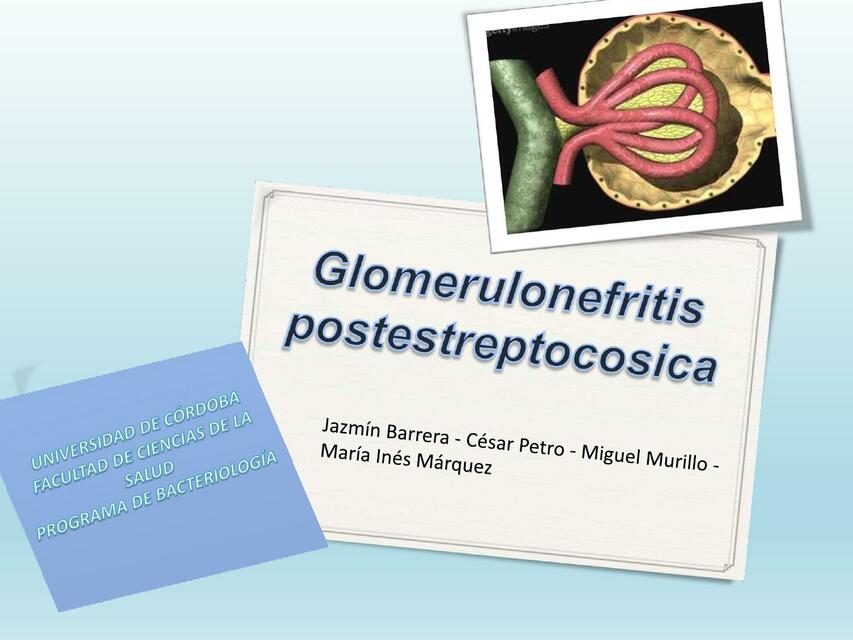 GLOMERULONEFRITIS ESTREPTOCOCCICA