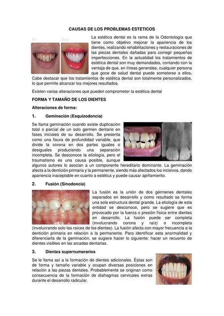 Causas de los problemas esteticos DISEÑO DE SONRISA