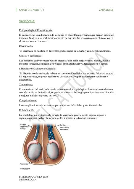 10 Varicocele