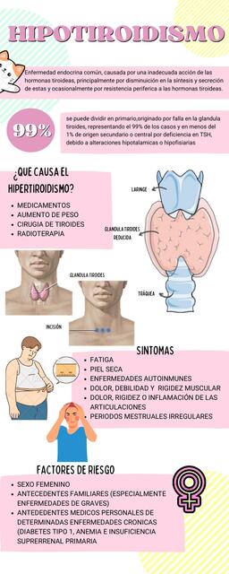 HIPOTIROIDISMO