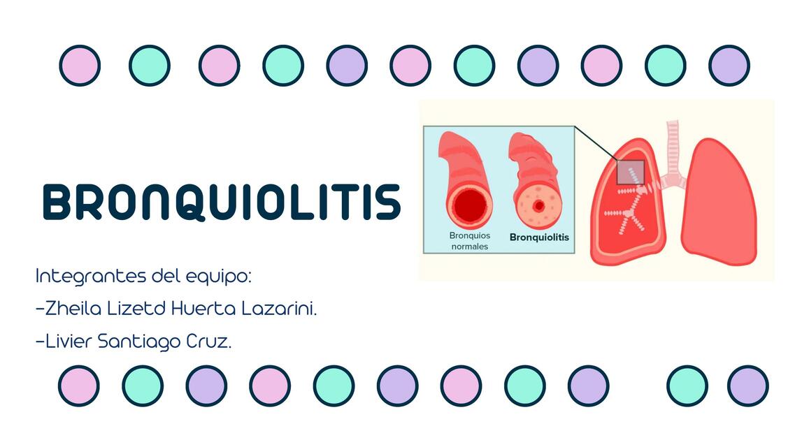 BRONQUIOLITIS