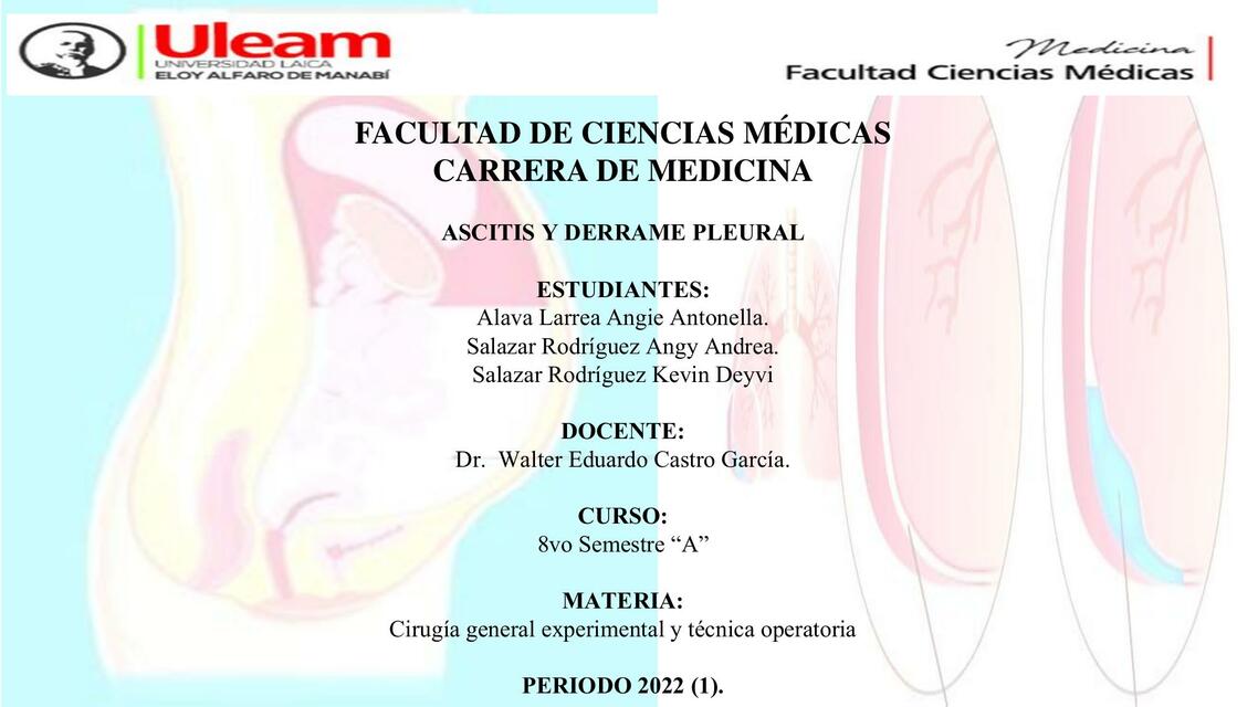 Ascitis y Derrame Pleural