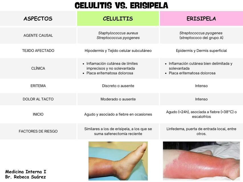 Celulitis vs Erisipela - Br Rebeca Suárez