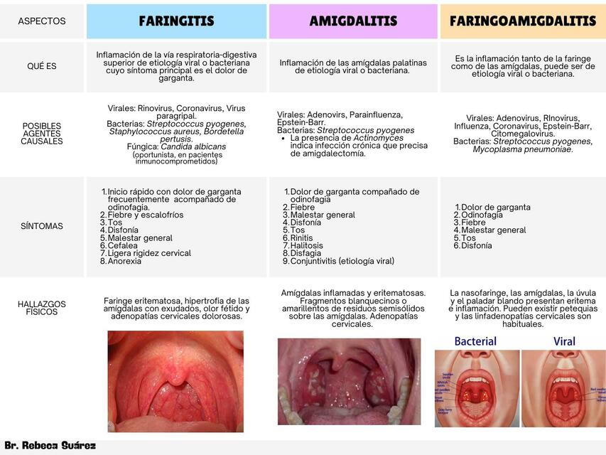 Faringitis, Amigdalitis y Faringoamigdalitis - Br Rebeca Suárez