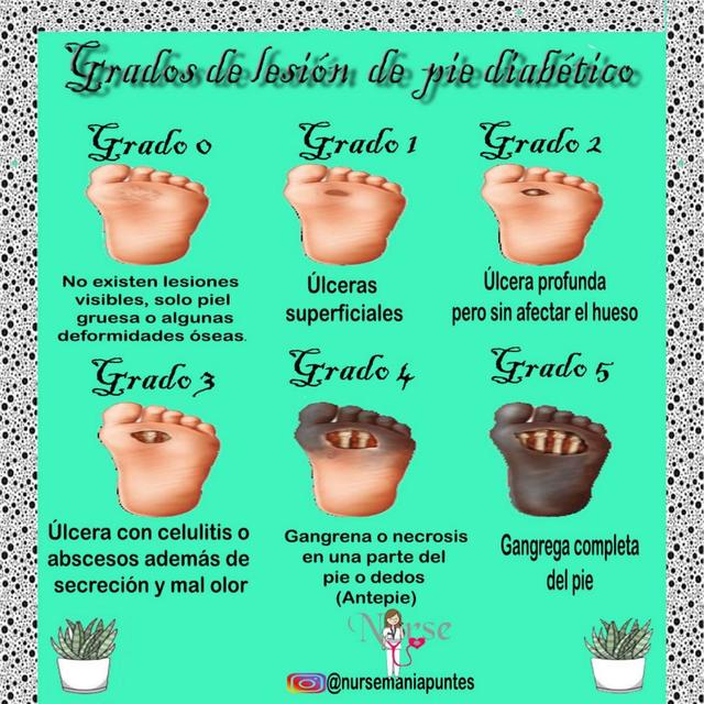 Grados de lesión de pie diábetico Nursemaniapuntes uDocz