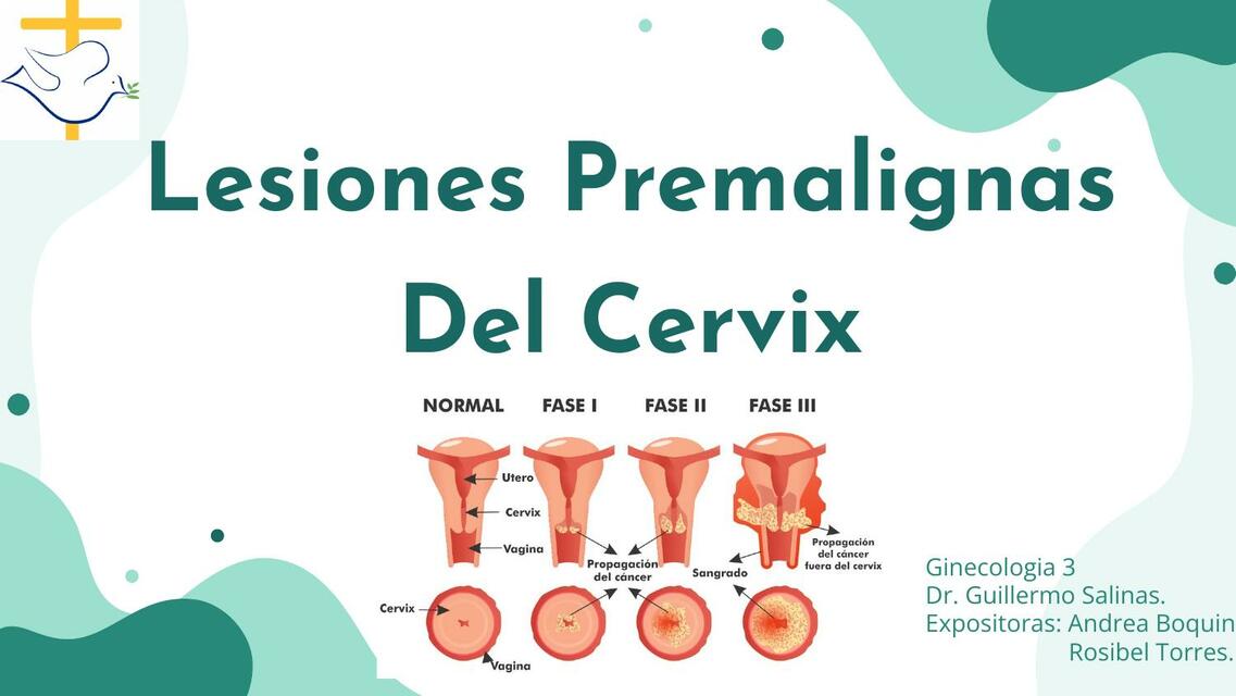 LESIONES PREMALIGNAS DEL CERVIX GO3 RF Y AB