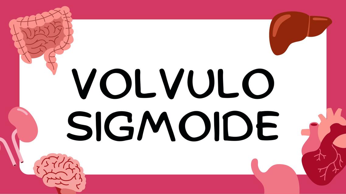 VOLVULO SIGMOIDE