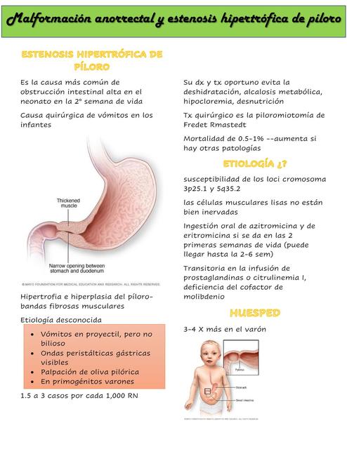 ESTENOSIS HIPERTRÓFICA DE PÍLORO | Patu MG | uDocz