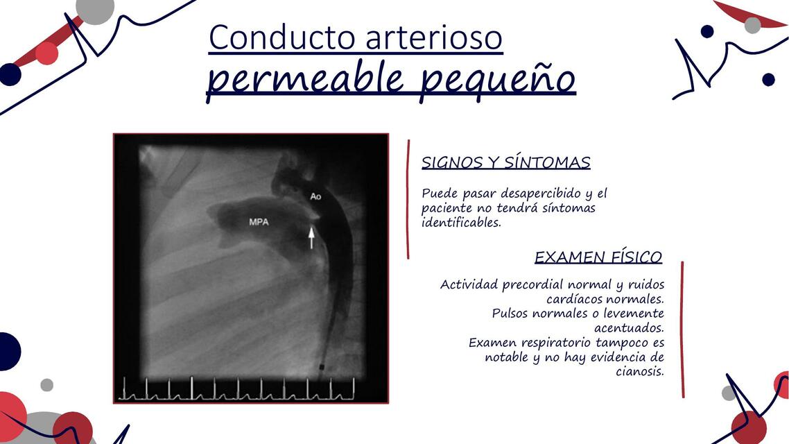 Cardiopatias Acianogenas