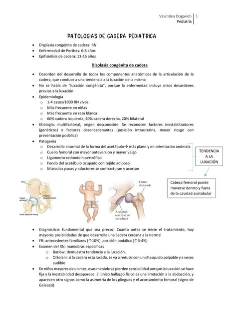 Patologías de Cadera Pediátrica