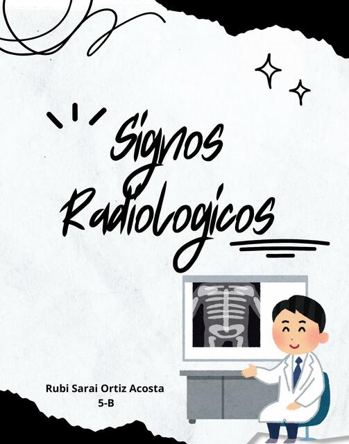 Signos Radiológicos