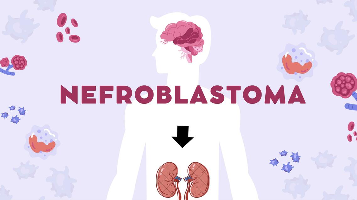 Nefroblastoma