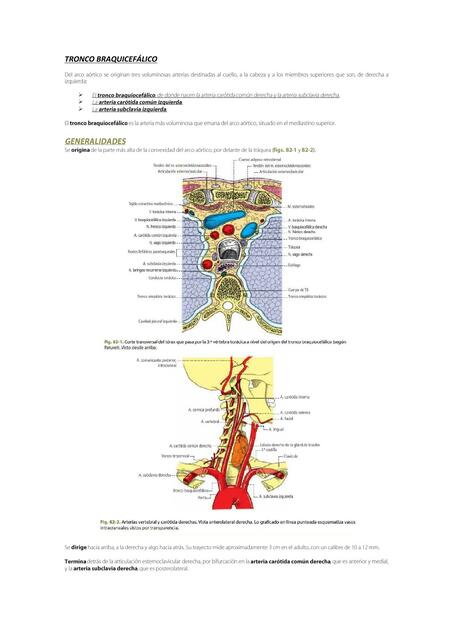 TRONCO ARTERIAL BRAQUICEFÁLICO