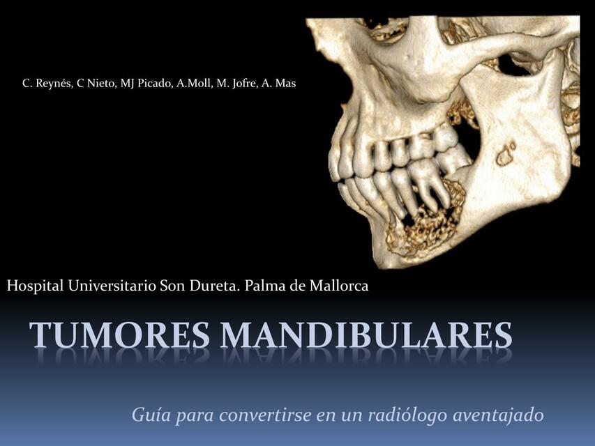 tumores mandibulares