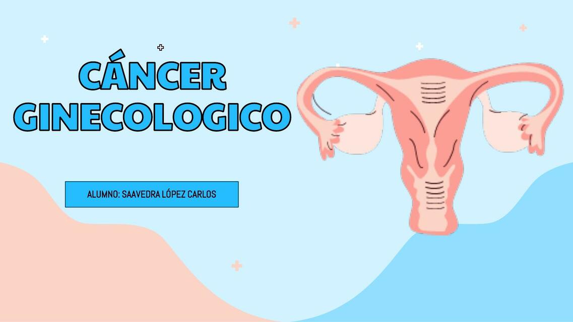 CÁNCER GINECOLOGICO/ CERVIX/ MAMA/ OVARIO/ ENDOMETRIO