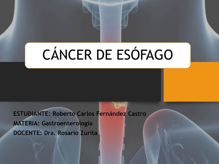 CANCER DE ESOFAGO