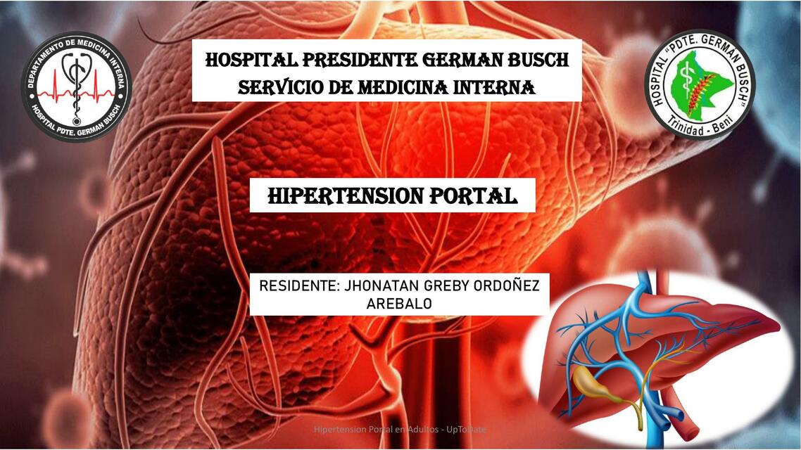 Articulo HIPERTENSION PORTAL