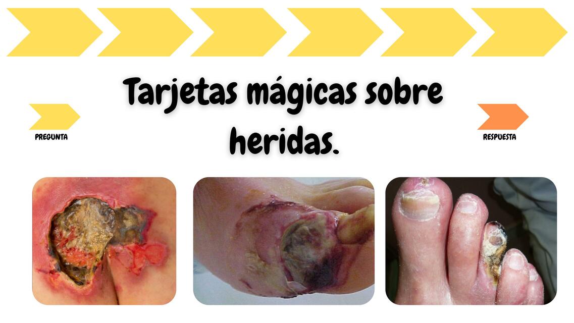 Flashcards: Heridas