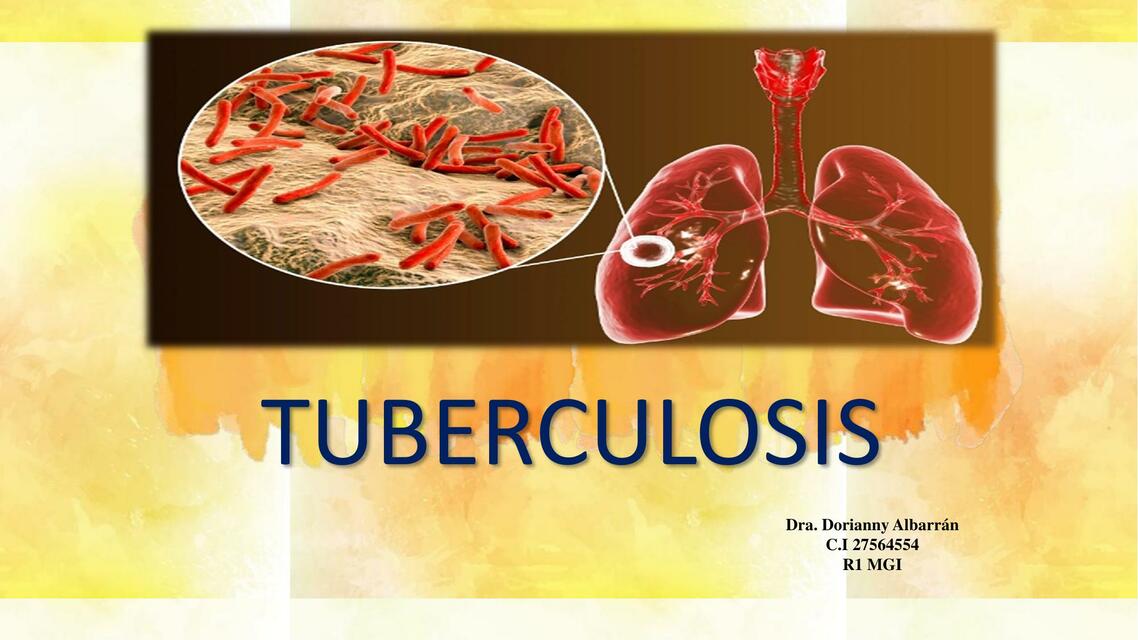 Tuberculosis Pulmonar