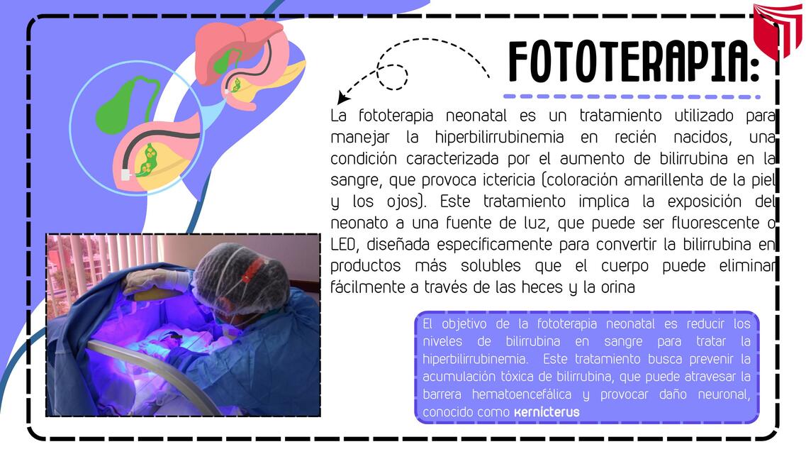 CUIDADOS DE ENFERMERIA EN FOTOTERAPIA