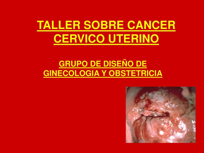 Cancer cervico uterino