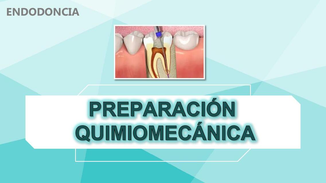 PREPARACION QUIMIOMECANICA-ENDODONCIA