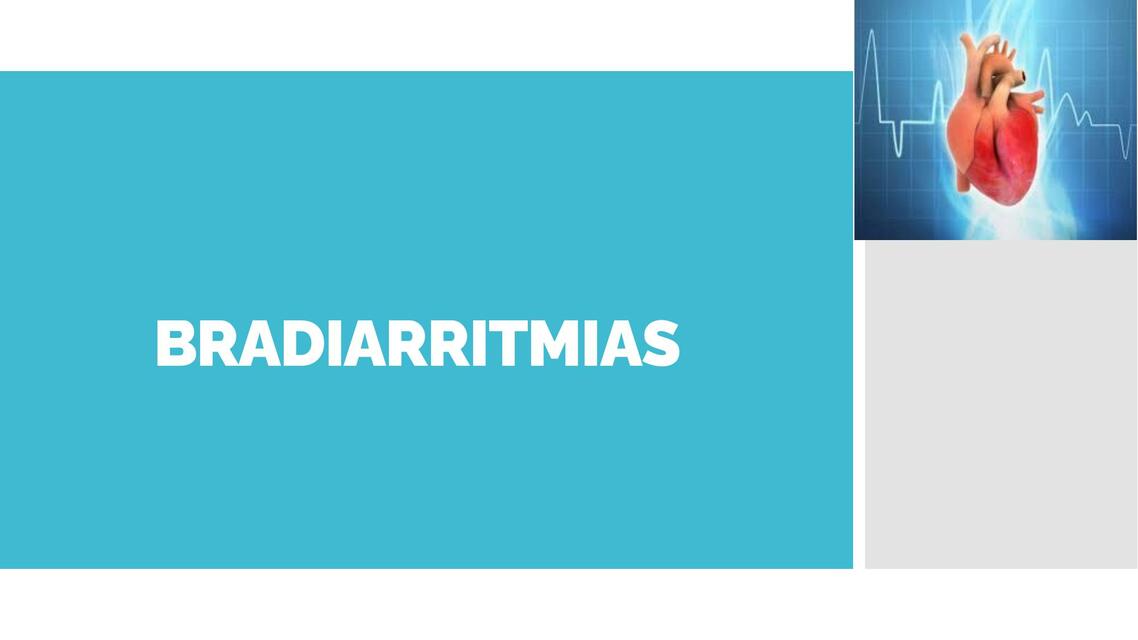 BRADIARRITMIAS