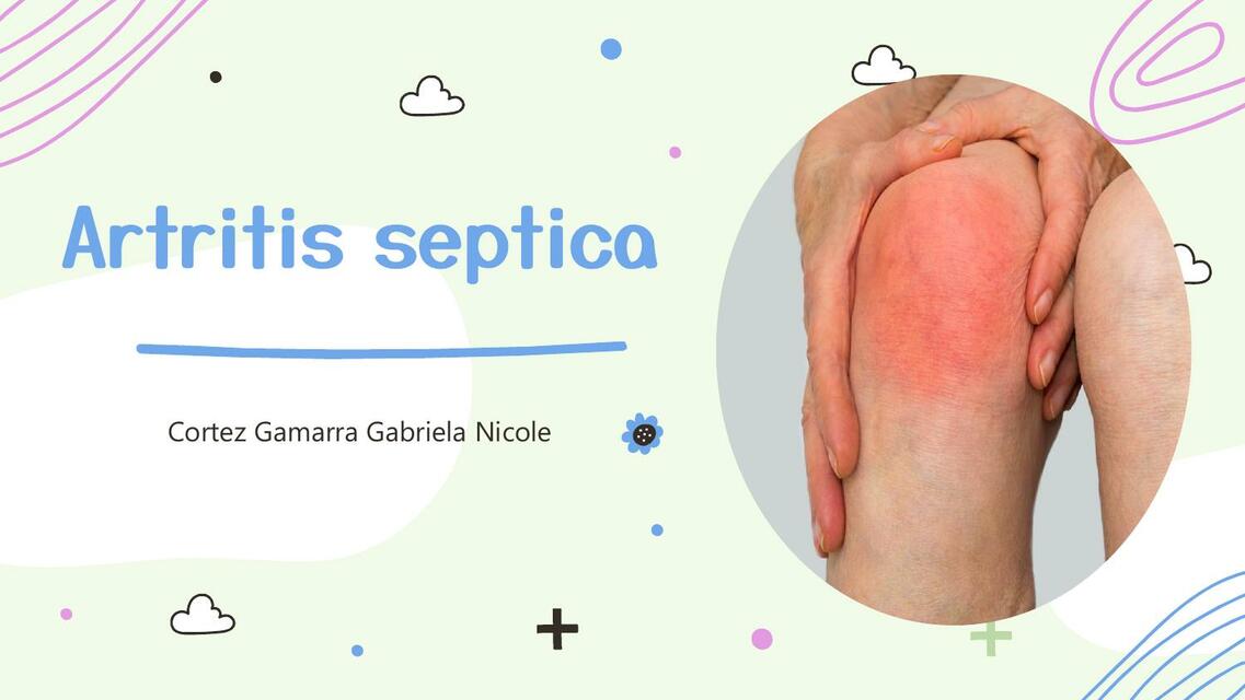 01 Artritis septica reativa gotosa pseudogota y ps