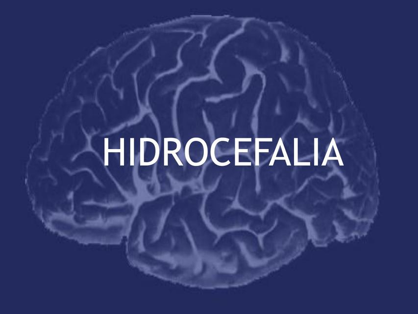 Neurocirugia 5 Hidrocefalia